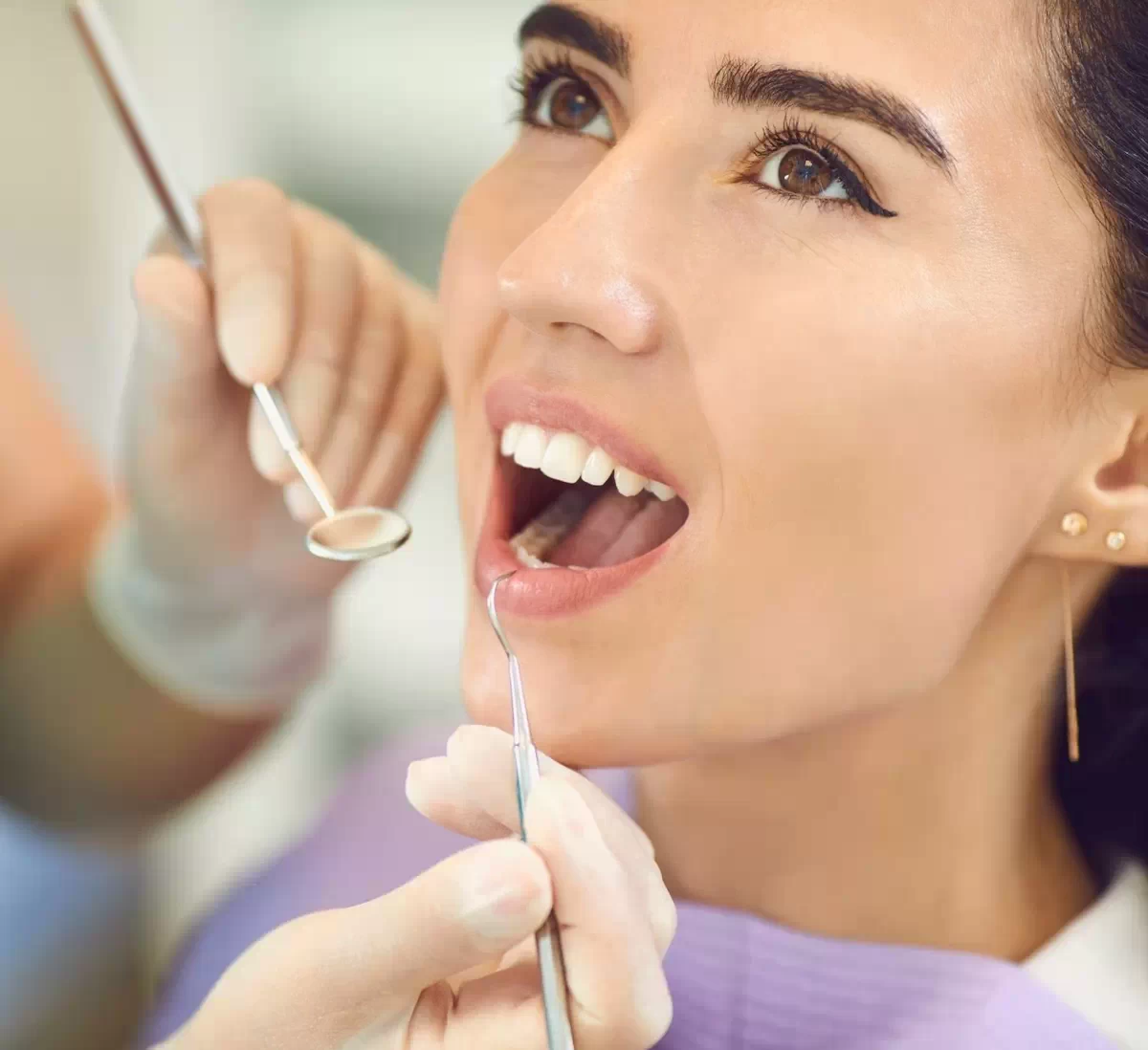 Albirea Dintilor Profesionala cu Philips Zoom la Dental CATTED