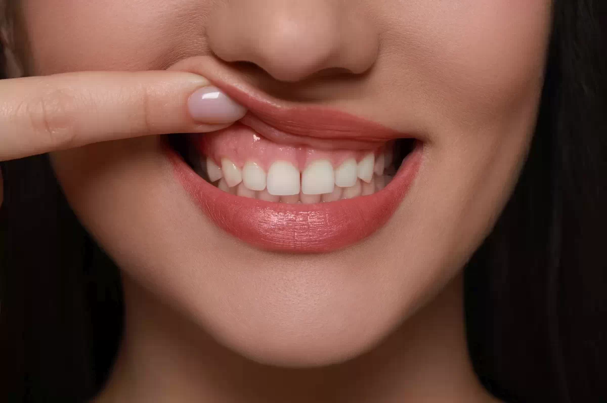 Tratamente Parodontoza si Afectiuni Gingivale la Dental CATTED in Pipera.