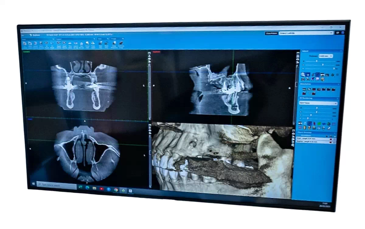 Radiologie Dentară - Investigări 2D și 3D