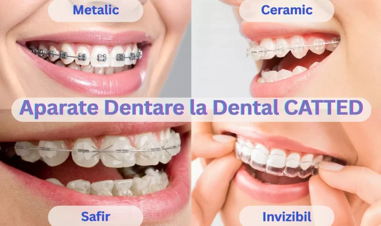 Imagine comparativă cu aparatele dentare metalice, ceramice, de safir și alignerele invizibile Spark disponibile la Dental CATTED.