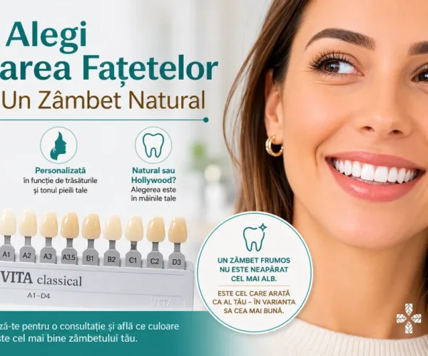 Alegerea culorii fațetelor dentare cu ajutorul ghidului VITA pentru un zâmbet natural